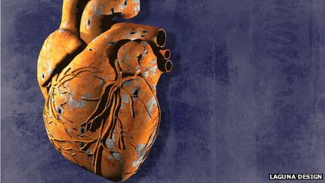 What causes coronary heart disease?