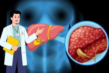 Is Fatty Liver Treatable? Gastroenterology Hospital in Delhi
