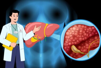 Is Fatty Liver Treatable? Gastroenterology Hospital in Delhi