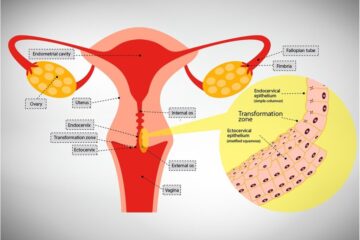 HPV (Human Papillomavirus) and Its Effects on Women’s Health