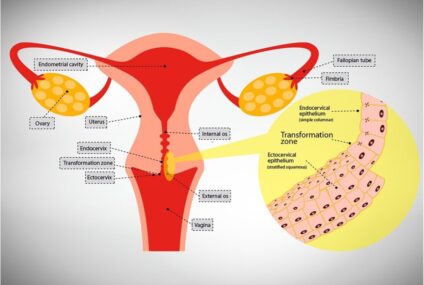 HPV (Human Papillomavirus) and Its Effects on Women’s Health