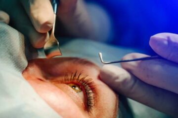 Why Delaying Cataract Surgery Can Harm Your Vision