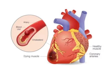 Diabetes and Your Heart: How Blood Sugar Impacts Your Arteries