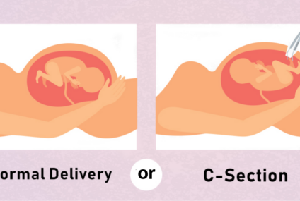 C-Section vs Normal Delivery: Key Differences Every Expectant Mother Should Know